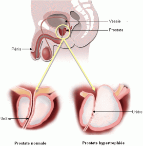 rapport_anatomie prostate