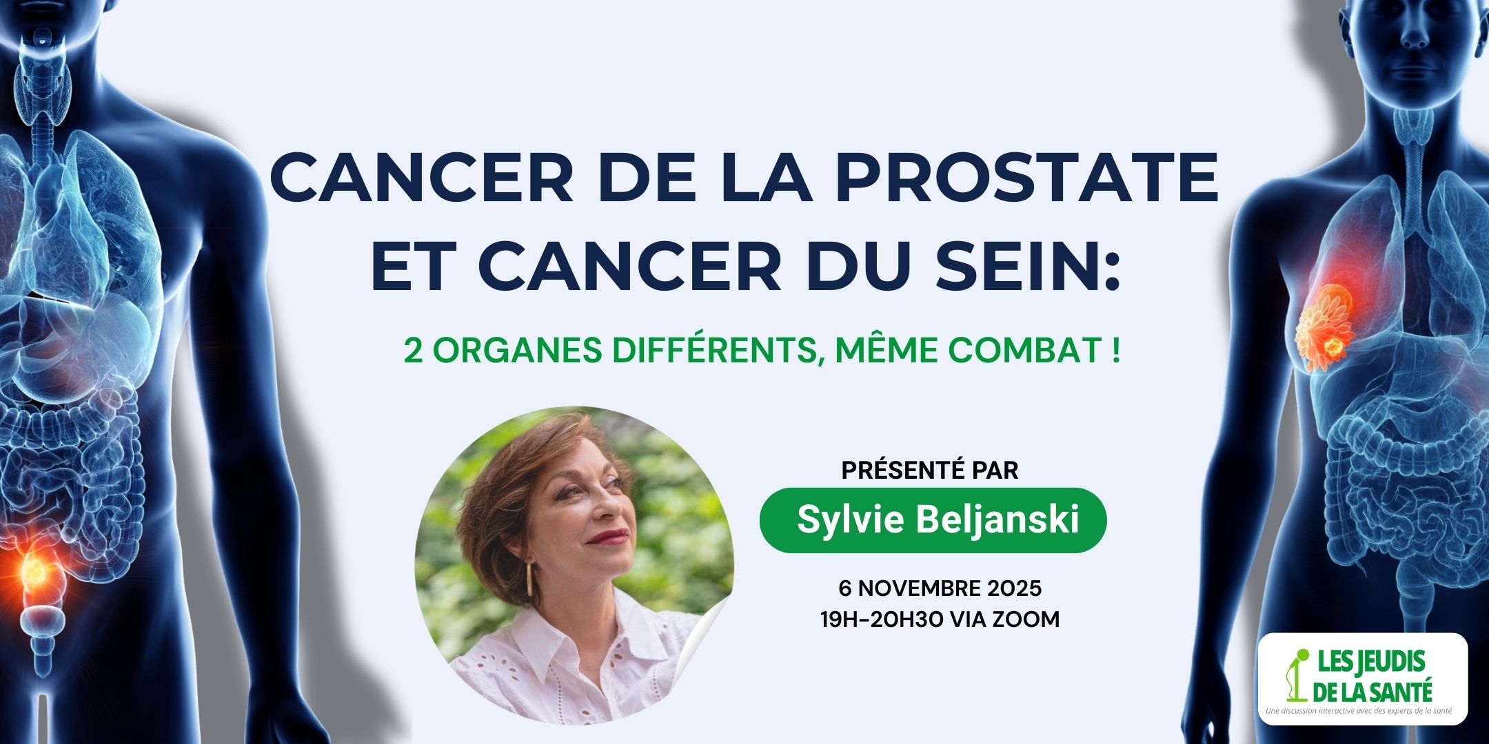 Cancer de la prostate et cancer du sein